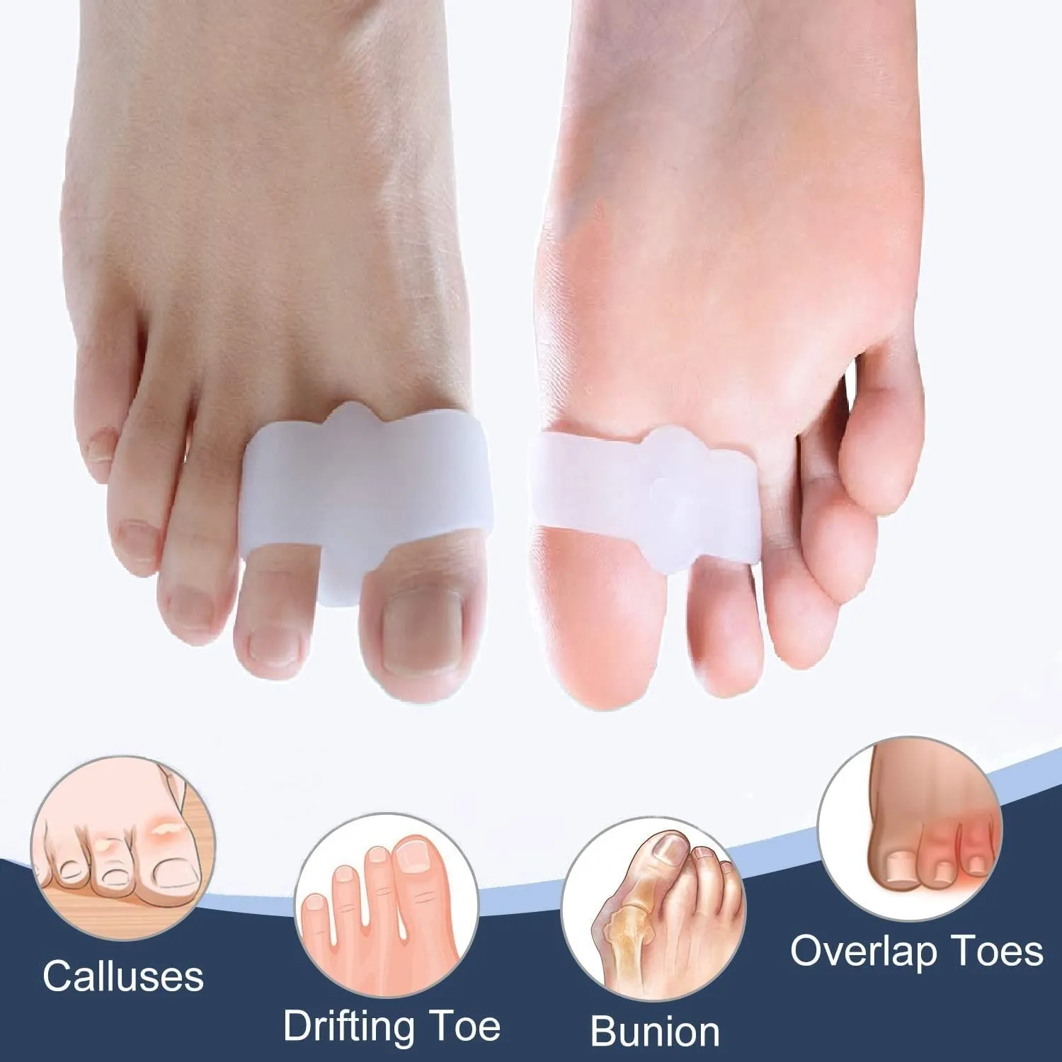 10 Pack Gel Toe Corrector Toe Separators with 2 Loops Big Toe Spacer for Bunion Pain and Overlapping Toe for Women & Men Straighten Overlapping Hammer Toe
